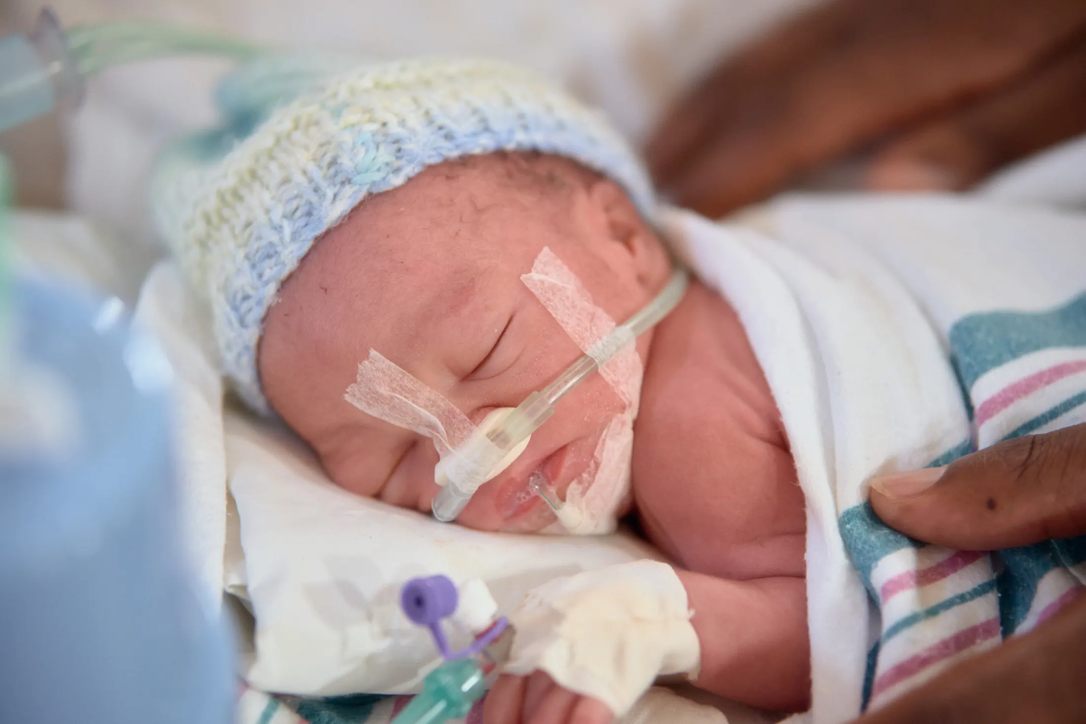 A tiny baby in a knitted hat sleeps in the neonatal unit